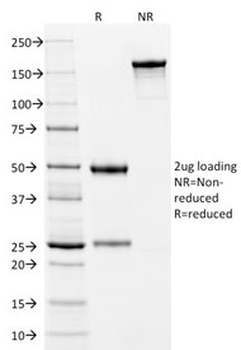 KRT10 Antibody / Cytokeratin 10