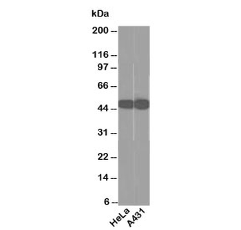 Cytokeratin 18 Antibody