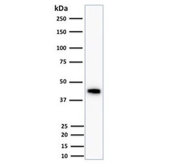 Cytokeratin 18 Antibody