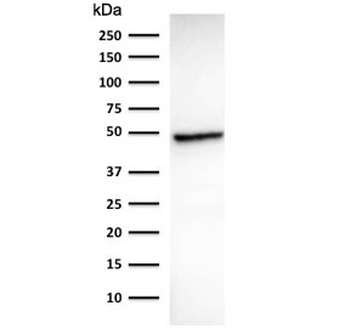 Cytokeratin 18 Antibody