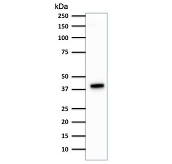 Cytokeratin 18 Antibody