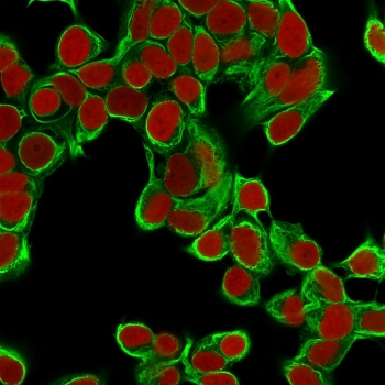 Cytokeratin 18 Antibody