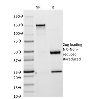 Cytokeratin 18 Antibody