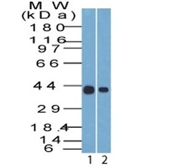 KRT19 Antibody / Cytokeratin 19
