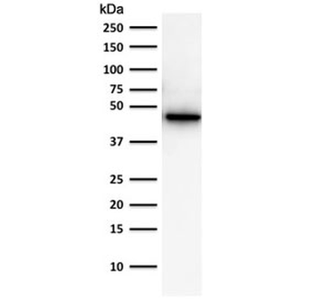 KRT19 Antibody / Cytokeratin 19