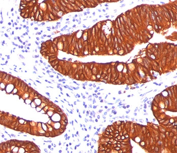 KRT19 Antibody / Cytokeratin 19