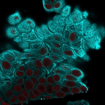 KRT19 Antibody / Cytokeratin 19