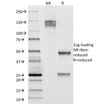 KRT19 Antibody / Cytokeratin 19