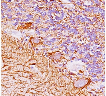 Neurofilament Antibody (-Heavy) / NF-H / NEFH