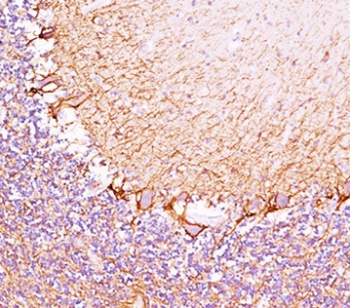 Neurofilament Heavy Antibody