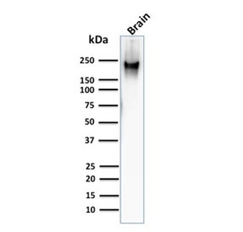 Neurofilament Antibody (-Heavy) / NF-H / NEFH