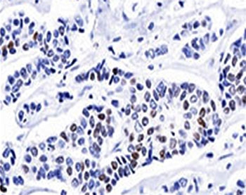 Progesterone Receptor Antibody