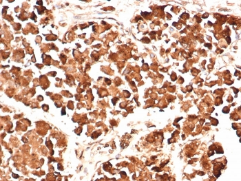 ACTH Antibody / Synacthen