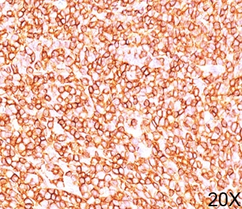 CD45RB Antibody (B-cell marker)