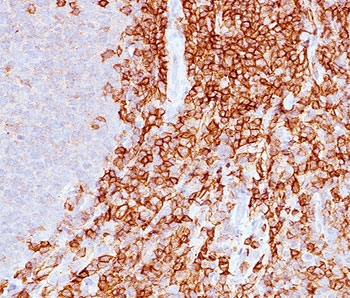 CD43 Antibody