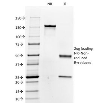 TG Antibody / Thyroglobulin