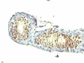 TGF alpha Antibody