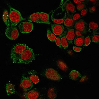 TNF alpha Antibody