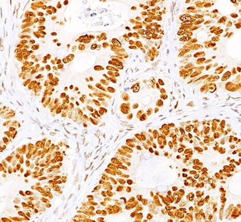 p53 Antibody Cocktail / TP53