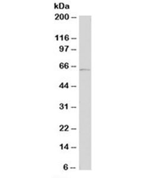 Tyrosinase Antibody