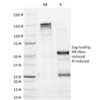 Tyrosinase Antibody