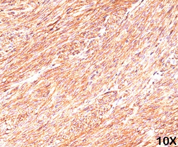 DOG1 Antibody / TMEM16A / ANO1