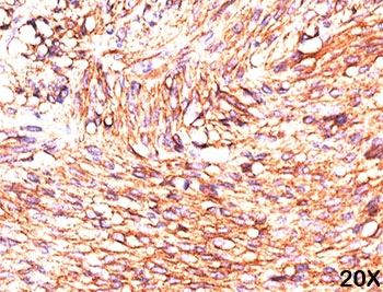 DOG1 Antibody / TMEM16A / ANO1
