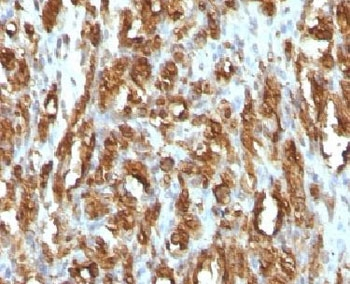 Actin Antibody (pan muscle)