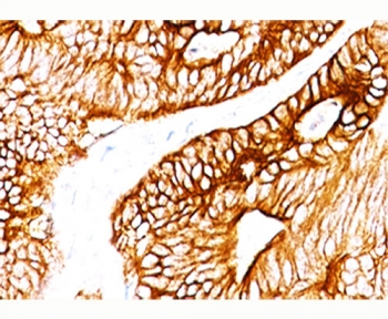 Cytokeratin 8/18 Antibody Cocktail