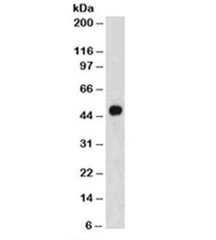 Cytokeratin 8/18 Antibody Cocktail