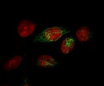 Basic Cytokeratin Antibody (HMW / Type II)
