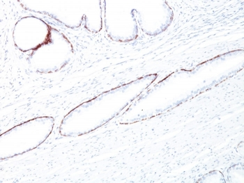 Basic Cytokeratin Antibody (HMW / Type II)