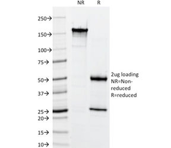 Basic Cytokeratin Antibody (HMW / Type II)
