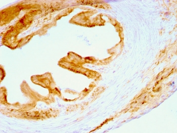 Cytokeratin Antibody, Multi 4/5/6/8/10/13/18