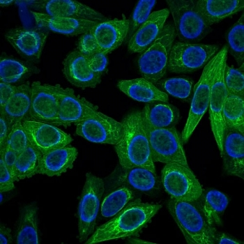 Cytokeratin Antibody, Multi 4/5/6/8/10/13/18