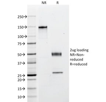 Cytokeratin Antibody, Multi 4/5/6/8/10/13/18