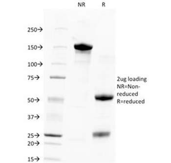 Human Nuclear Antigen Antibody