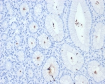 H pylori Antibody (Catalase)