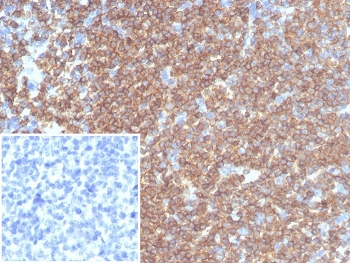 Recombinant CD45RA Antibody (Leukocyte marker)