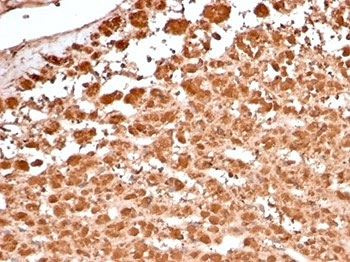 Recombinant Aldose reductase 1B1 Antibody / AKR1B1