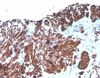 Desmin Antibody