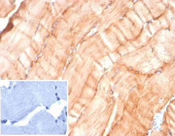 Desmin Antibody