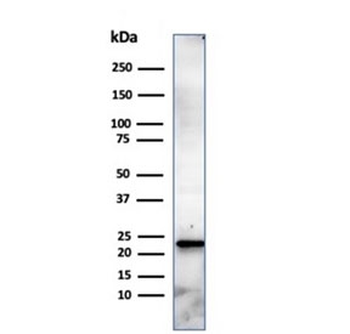 CBF beta Antibody / CBFB