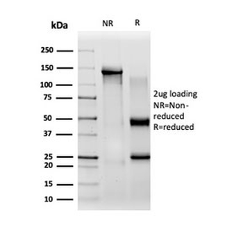 CBF beta Antibody / CBFB
