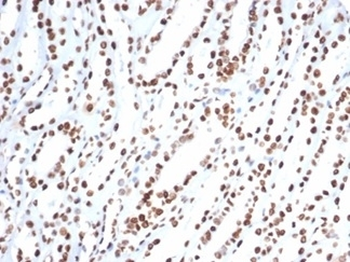 Ku80 Antibody / XRCC5