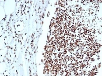 Ku80 Antibody / XRCC5