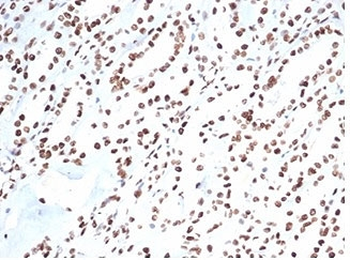 Ku80 Antibody / XRCC5