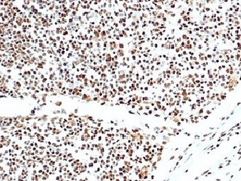 Ku80 Antibody / XRCC5