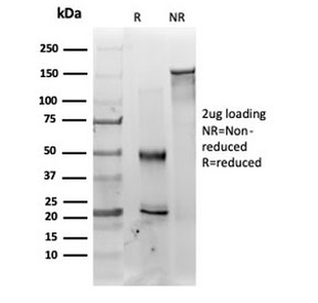 MED22 Antibody