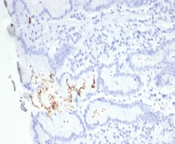 Helicobacter pylori Antibody (Catalase)